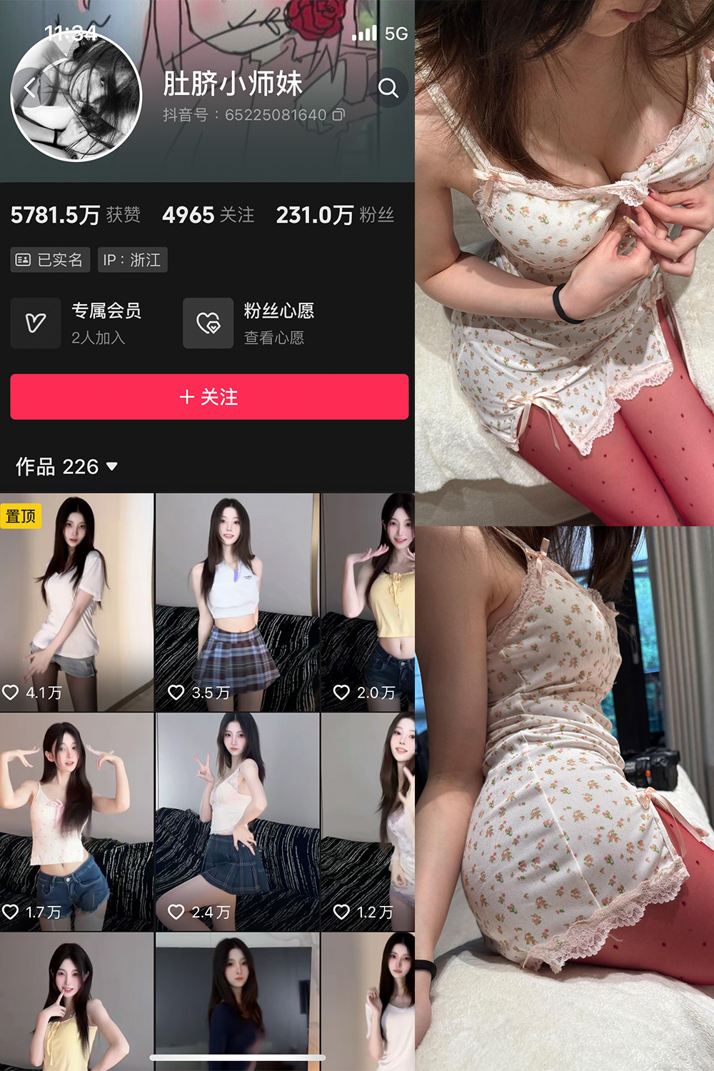 抖音 肚脐小师妹 微密圈 NO.037期 【15P2V】最新至:2025.4.23