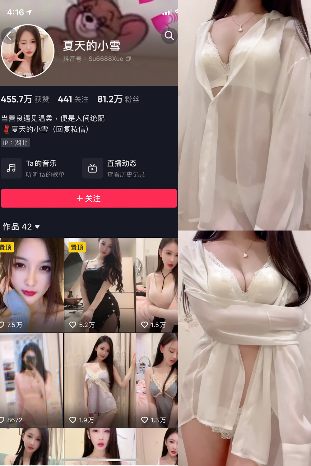 抖音 夏天的小雪 微密圈 嘉宾专享 NO.011期 【4P2V】最新至:2023.8.11