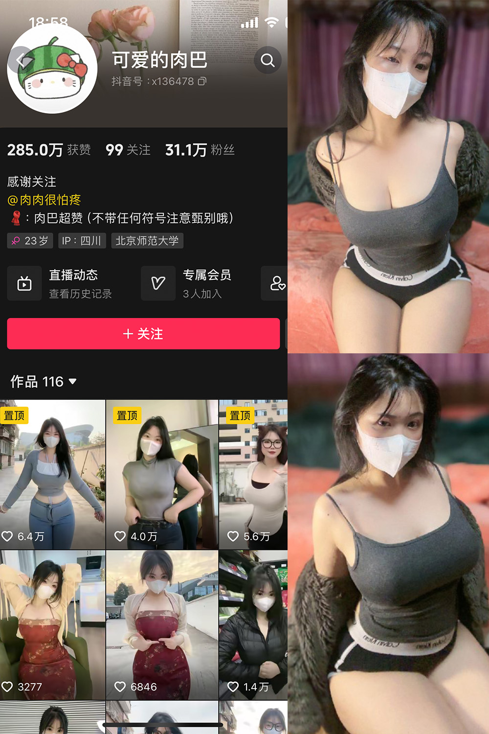 抖音 可爱的肉巴 微密圈 NO.011期 【14P6V】最新至:2024.2.19