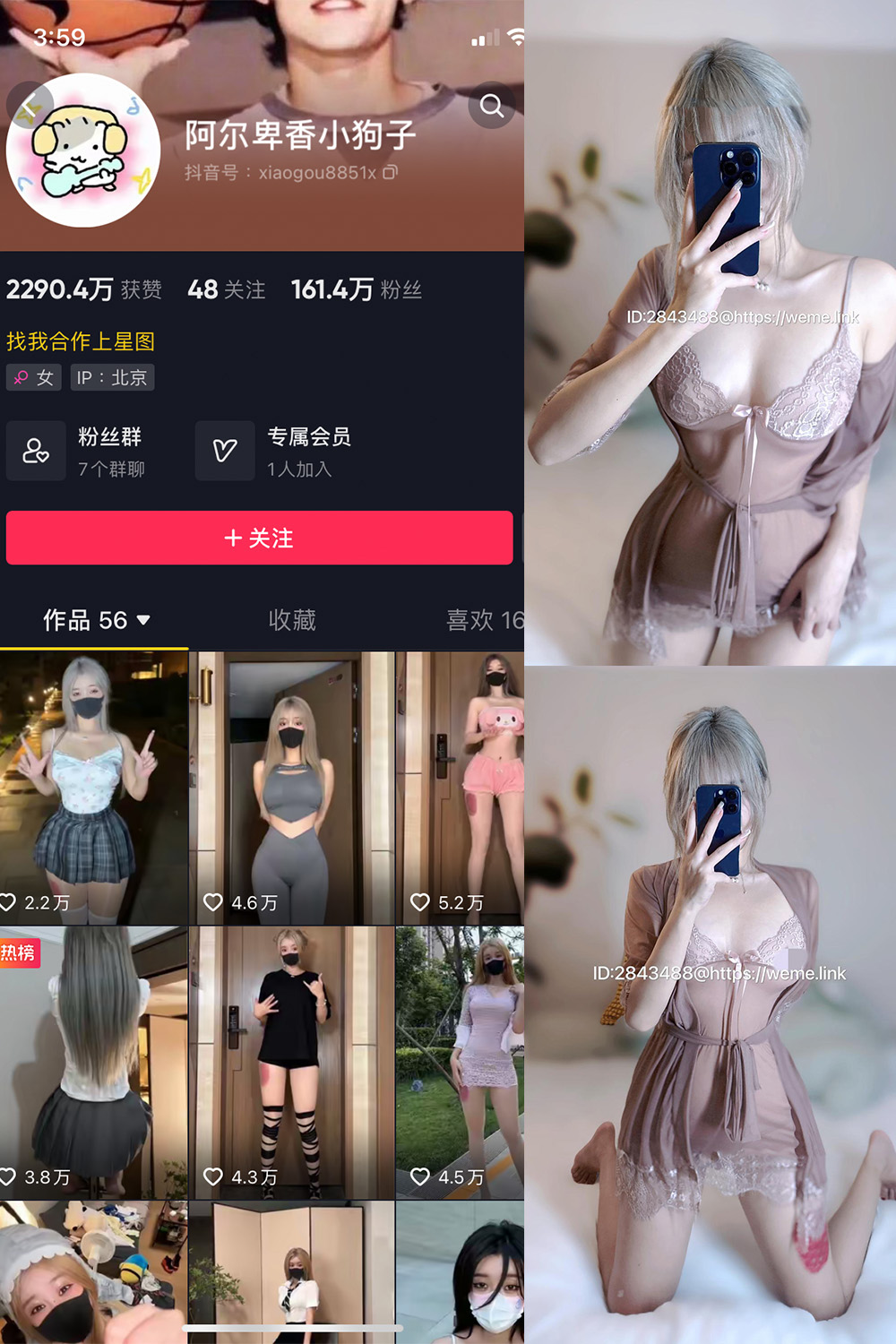 抖音 阿尔卑香小狗子 微密圈 NO.007期 【15P】